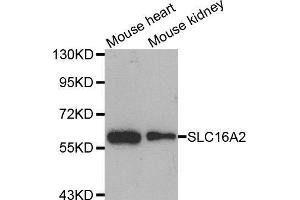 Western blot analysis of extracts of various cell lines, using SLC16A2 antibody. (SLC16A2/MCT8 Antikörper  (AA 1-100))