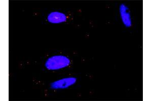 Proximity Ligation Analysis of protein-protein interactions between GRAP2 and CSF1R. (CSF1R Antikörper  (AA 21-120))