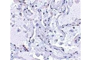 Immunohistochemistry (IHC) image for anti-Transition Protein 1 (During Histone To Protamine Replacement) (TNP1) (N-Term) antibody (ABIN1031638) (TNP1 Antikörper  (N-Term))