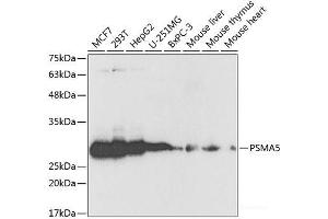 Western blot analysis of extracts of various cell lines using PSMA5 Polyclonal Antibody at dilution of 1:1000. (PSMA5 Antikörper)