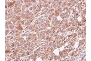 IHC-P Image Immunohistochemical analysis of paraffin-embedded SAS xenograft, using G protein alpha Inhibitor 3, antibody at 1:500 dilution. (G Protein alpha Inhibitor 3 (Center) Antikörper)