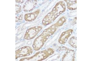 Immunohistochemistry (IHC) image for anti-NADH Dehydrogenase (Ubiquinone) 1 beta Subcomplex, 4, 15kDa (NDUFB4) (AA 1-90) antibody (ABIN6144476)