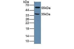 Detection of LOXL1 in Mouse Eye Tissue using Polyclonal Antibody to Lysyl Oxidase Like Protein 1 (LOXL1) (LOXL1 Antikörper  (AA 392-598))