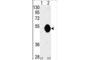 Western blot analysis of DOK2 (arrow) using DOK2 Antibody (C-term) (ABIN392072 and ABIN2841834). (DOK2 Antikörper  (C-Term))