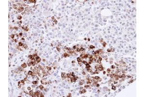 Immunohistochemistry (IHC) image for anti-Gelsolin (GSN) (C-Term) antibody (ABIN2854963)