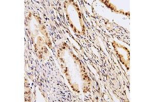 IHC analysis of PHF21A using anti-PHF21A antibody (ABIN6719353).