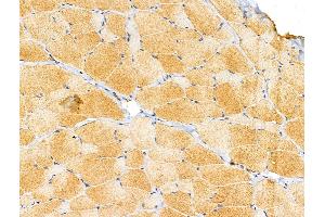 ABIN6257350 and ABIN6274727 at 1/100 staining Rat skin tissue by IHC-P.