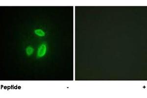 Immunofluorescence analysis of HUVEC cells, using ESPL1 polyclonal antibody .