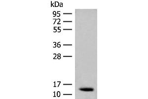 Western blot analysis of Human fetal brain tissue lysate using AKAP7 Polyclonal Antibody at dilution of 1:200 (AKAP7 Antikörper)