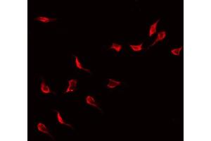 ABIN6268958 staining Hela by IF/ICC. (LCK Antikörper  (N-Term))