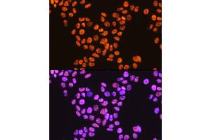 Immunofluorescence (IF) image for anti-TAR DNA Binding Protein (TARDBP) antibody (ABIN7270730)