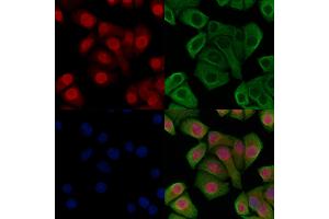 ABIN6266224 and ABIN6277495 staining Hela cells(heat shock treatment) by IF/ICC. (Histone 3 Antikörper  (H3K14me1))
