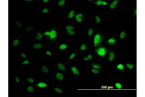 Immunofluorescence of monoclonal antibody to STK6 on HeLa cell. (Aurora A Antikörper  (AA 1-110))