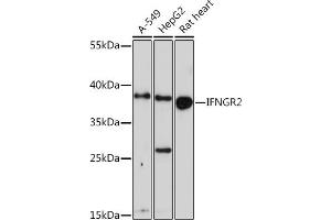 Western blot analysis of extracts of various cell lines, using IFNGR2 Rabbit pAb (ABIN6134791, ABIN6142199, ABIN6142201 and ABIN6218514) at 1:1000 dilution. (IFNGR2 Antikörper  (C-Term))