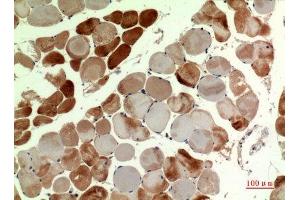 Immunohistochemistry (IHC) analysis of paraffin-embedded Human Muscle, antibody was diluted at 1:100. (MUTYH Antikörper  (pan))