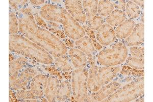 Immunohistochemistry (IHC) image for anti-Tumor Protein P73 (TP73) (pTyr99) antibody (ABIN6256817)