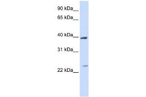 WB Suggested Anti-ACADL Antibody Titration:  0.