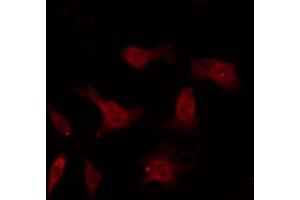 ABIN6267326 staining 293 by IF/ICC. (Tyrosine Hydroxylase Antikörper  (pSer40))