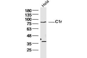 Human Hela cells probed with C1r Polyclonal Antibody, unconjugated  at 1:300 overnight at 4°C followed by a conjugated secondary antibody at 1:10000 for 90 minutes at 37°C.