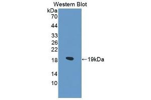 Western Blotting (WB) image for anti-Collagen, Type VI, alpha 1 (COL6A1) (AA 828-1022) antibody (ABIN1175577) (COL6A1 Antikörper  (AA 828-1022))