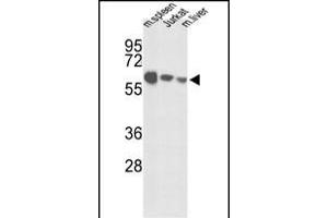 Western blot analysis of IGFALS Antibody (Center) (ABIN391690 and ABIN2841595) in mouse spleen tissue, Jurkat cell line and mouse liver tissue lysates (35 μg/lane). (IGFALS Antikörper  (AA 308-335))