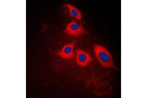 Immunofluorescent analysis of ARRDC3 staining in Jurkat cells. (ARRDC3 Antikörper  (C-Term))