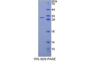 SDS-PAGE (SDS) image for Nuclear Receptor Subfamily 0, Group B, Member 1 (NR0B1) protein (ABIN6118847)