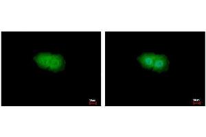 ICC/IF Image p90 RSK1 antibody detects p90 RSK1 protein at Cytoplasm and Nucleus by immunofluorescent analysis. (RPS6KA1 Antikörper  (Center))