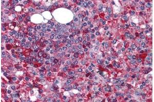 Human Spleen: Formalin-Fixed, Paraffin-Embedded (FFPE) (Anoctamin 2 Antikörper  (N-Term))