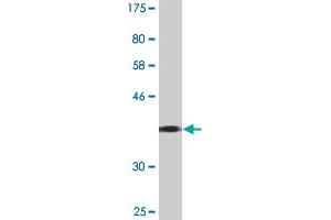 Western Blot detection against Immunogen (36. (GIT2 Antikörper  (AA 401-498))