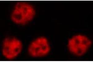 ABIN6269307 staining RAW264. (NFKB2 Antikörper  (C-Term))