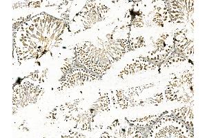 ABIN7094458 and ABIN7098506 at 1/100 staining Rat testis tissue by IHC-P. (CBX7 Antikörper  (N-Term))