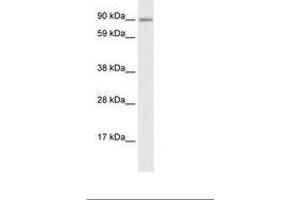 Image no. 1 for anti-Zinc Finger Protein 537 (ZNF537) (AA 466-515) antibody (ABIN6735913) (TSHZ3 Antikörper  (AA 466-515))