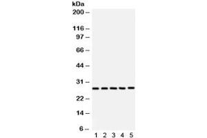 Western blot testing of 1) rat brain, 2) rat testis, 3) NEURO, 4) 293 and 5) SW620 lysate with SF2 antibody. (SRSF1 Antikörper)