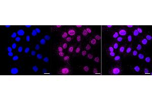 Immunocytochemical staining of HT- cells with Cullin 1 antibody (ABIN7798176), 1:1,000). (Rekombinanter Cullin 1 Antikörper)