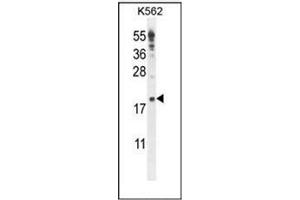 Western blot analysis of IQCJ Antibody (C-term) in K562 cell line lysates (35ug/lane). (IQCJ Antikörper  (C-Term))