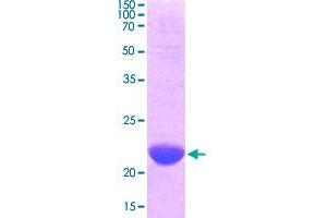 Image no. 1 for Second Mitochondria-Derived Activator of Caspase (DIABLO) (AA 56-239) protein (ABIN5569492)