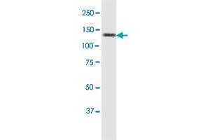 Western Blotting (WB) image for anti-SMC6 Structural Maintenance of Chromosomes 6-Like 1 (SMC6) (AA 1-110) antibody (ABIN566368)