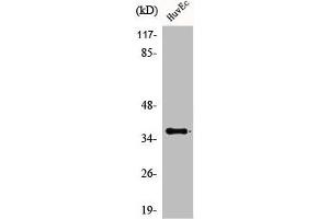 Western Blot analysis of HuvEc cells using ACOT8 Polyclonal Antibody (ACOT8 Antikörper  (Internal Region))