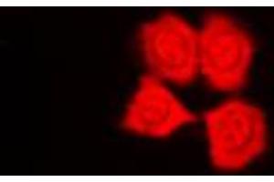 Immunofluorescent analysis of PKN1 staining in HepG2 cells. (PKN1 Antikörper  (Center))