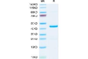 Mouse EMAP-II/AIMP1 on Tris-Bis PAGE under reduced condition. (AIMP1 Protein (AA 2-310) (His tag))