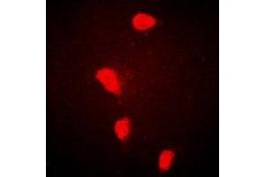 Immunofluorescent analysis of FHL-1 staining in Hela cells.