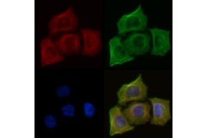 ABIN6259895 and ABIN6273991 staining Hela cells(45 min of heat-shock) by IF/ICC. (TUBA4A Antikörper  (N-Term))