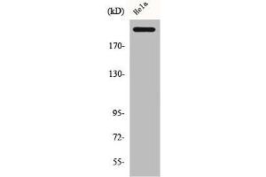 Western Blot analysis of HeLa cells using CBP Polyclonal Antibody (CBP Antikörper  (C-Term))
