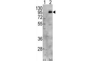 Western Blotting (WB) image for anti-Phosphatidylinositol-4-Phosphate 5-Kinase, Type I, gamma (PIP5K1C) antibody (ABIN3003648) (PIP5K1C Antikörper)