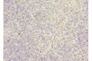 Immunohistochemistry of paraffin-embedded human thymus tissue using ABIN7170393 at dilution of 1:100 (SNX32 Antikörper  (AA 144-403))