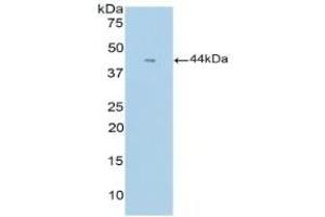 Detection of Recombinant GCSF, Mouse using Polyclonal Antibody to Colony Stimulating Factor 3, Granulocyte (GCSF) (G-CSF Antikörper  (AA 55-206))