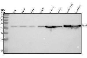 Western blot analysis of SDHB using anti-SDHB antibody (ABIN7606255).