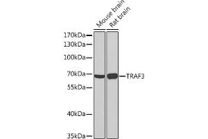 Western blot analysis of extracts of various cell lines, using TR Rabbit pAb (ABIN7270836) at 1:1000 dilution.
