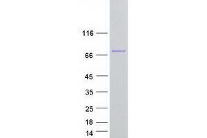 Western Blotting (WB) image for Exosome Component 9 (EXOSC9) (Transcript Variant 1) protein (Myc-DYKDDDDK Tag) (ABIN2720636)